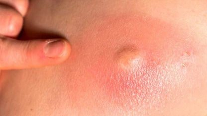 Oravia Healing Marham for skin problems
