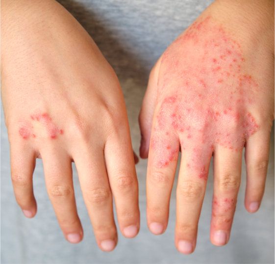 Oravia Healing Marham for skin problems