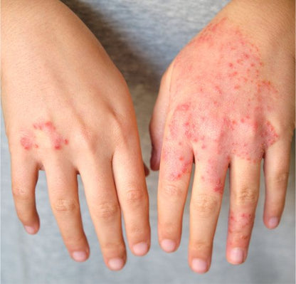 Oravia Healing Marham for skin problems