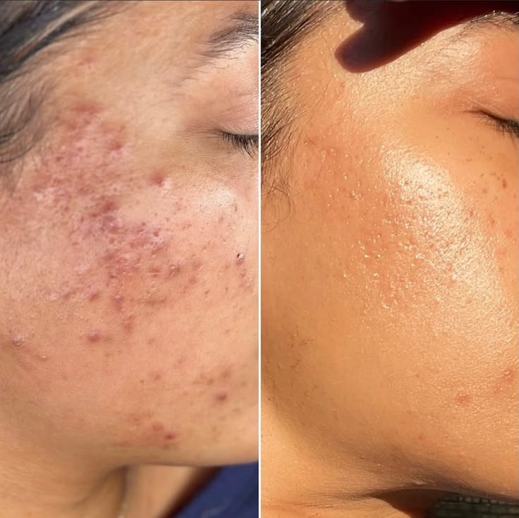 Oravia Healing Marham for skin problems